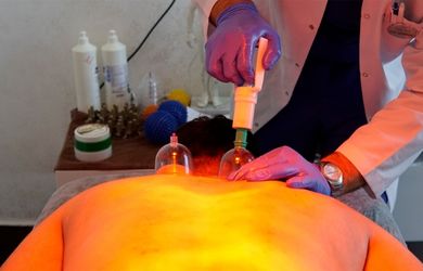 Kupa Tedavisi (Hacamat)