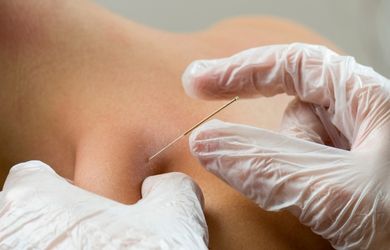 Kuru İğne Tedavisi